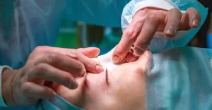 Od krzywego do idealnego: operacja nosa