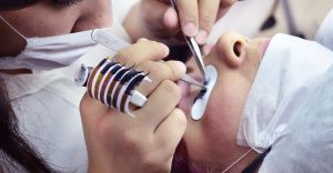 Depilacja laserowa - wanie jest najlepszy okres aby j wykona