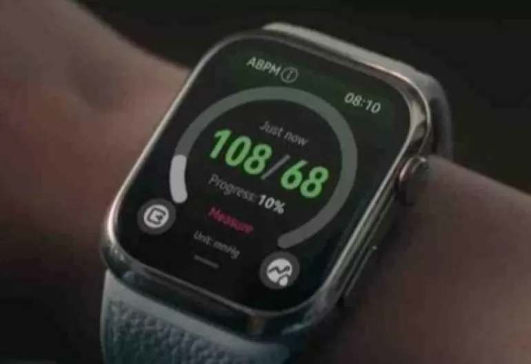 smartwatch